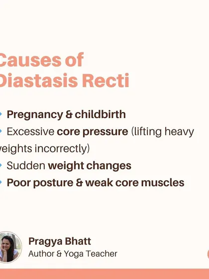 This infographic explains the common causes of Diastasis Recti, or abdominal separation. It can be caused by pregnancy, excessive core pressure from incorrect lifting, sudden weight changes, or poor posture.