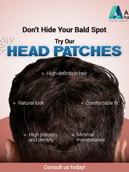 Our head patches are designed with high-definition hair for a natural look and comfortable fit. They feature high porosity and density for a realistic appearance with minimal maintenance.