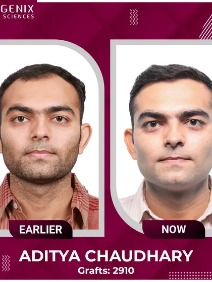Sub-inspector Aditya Chaudhary explains how his undetectable transplant restored the confidence he needs in his line of duty.