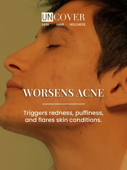 If you struggle with acne, sugar could be a trigger. It can worsen acne by increasing inflammation and oil production.
