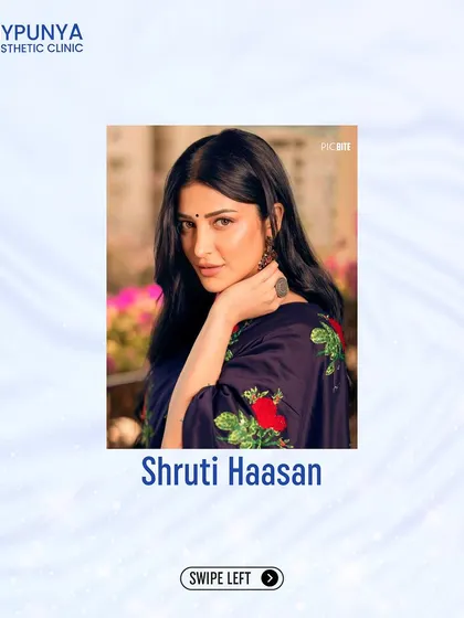 Shruti Haasan is another public figure who has been transparent about her lip enhancement and rhinoplasty procedures, contributing to a more accepting perspective on cosmetic treatments.