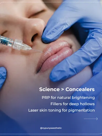 Science is more effective than concealers. For under-eye concerns, I use PRP for natural brightening, fillers for deep hollows, and laser skin toning for pigmentation.