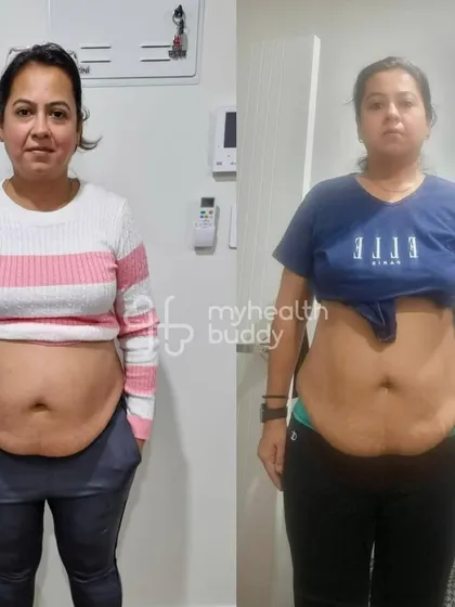 This client's progress was slow due to a medical condition, but she never stopped. Her journey shows that progress isn't just the number on the scale; it's about inch loss, feeling more energetic, and building new habits.