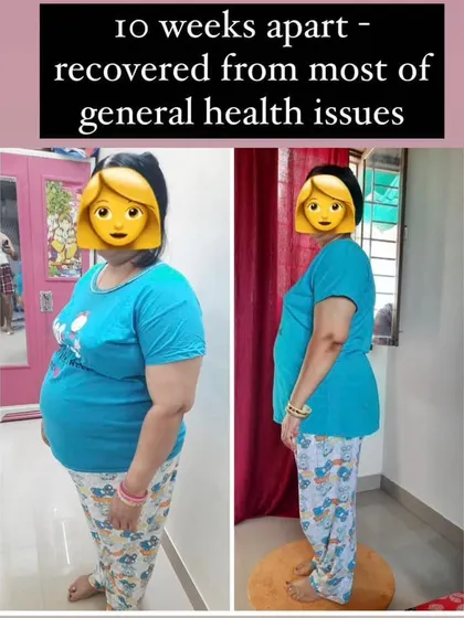 In just 10 weeks, this client not only lost weight but also recovered from several general health issues. This shows that the right nutrition plan improves your overall well being, not just your appearance.