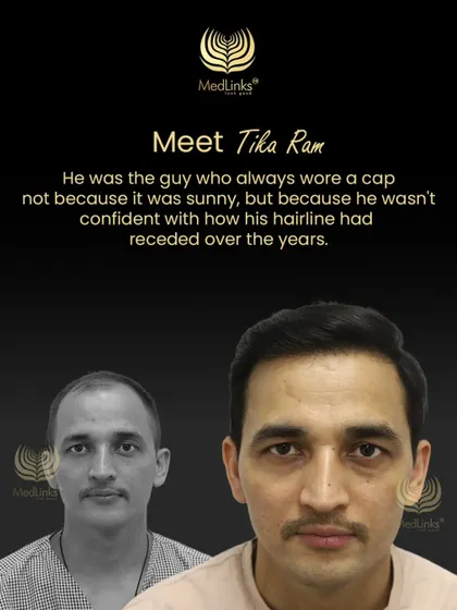 This collage tells the story of Tika Ram, who used to wear a cap to hide his receded hairline but now walks with confidence.