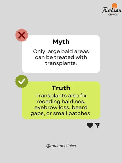 Myth: Transplants are only for large bald areas. Truth: I perform transplants for many needs, including fixing receding hairlines, filling gaps in beards or eyebrows, and covering small patches.