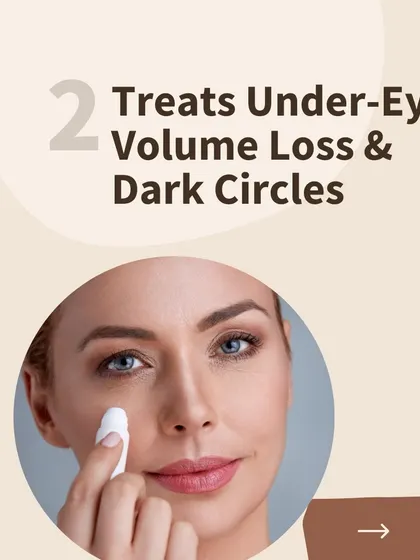 This treatment is excellent for addressing under-eye volume loss and dark circles. PlasmoDerm helps to restore lost volume and improve the thin skin under the eyes, reducing the appearance of shadows and hollowness.