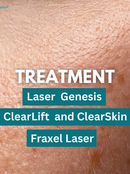 A list of treatments we offer for enlarged pores, including Laser Genesis, ClearLift, ClearSkin, and Fraxel Laser.
