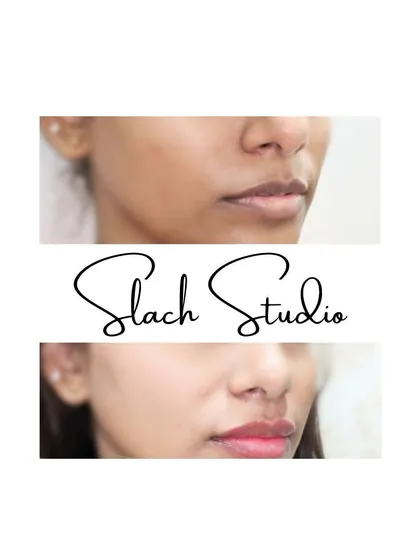 Achieve that coveted "glass skin" look with my Korean Skin Treatment. This before-and-after shows how the treatment evens out skin tone, reduces pigmentation, and imparts a luminous, healthy glow. It’s a fantastic way to get radiant skin without layers of makeup.