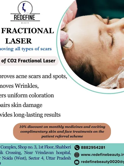 An overview of the benefits of CO2 fractional laser treatment. It is a versatile solution that not only improves acne scars and spots but also helps with wrinkles and repairs skin damage for long-lasting results.