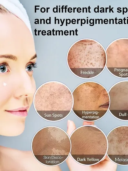 From freckles and sun spots to melasma and general dullness, I offer treatments for a wide range of pigmentation concerns. Each circle here represents a condition I can help you manage effectively and safely.