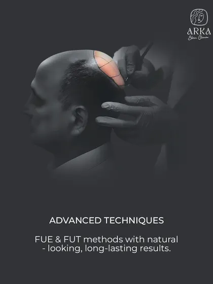 We specialize in advanced FUE and FUT hair transplant methods. Our focus is on creating long-lasting, natural-looking results by carefully planning the placement and angle of each hair follicle.