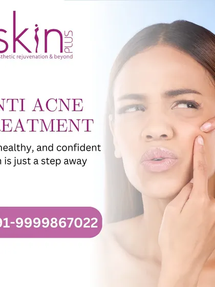 An image promoting my anti-acne treatment, assuring clients that clear, healthy, and confident skin is just a step away.