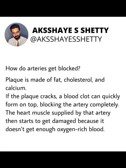 How do arteries get blocked? Plaque, made of fat and cholesterol, builds up. If that plaque cracks, a blood clot can form, blocking the artery and damaging the heart muscle.