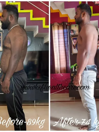 Mr. Devraj from Belagola lost 15 kg, going from 89 kg to 74 kg. More importantly, his transformation helped him reverse high cholesterol and blood pressure issues, proving that fat loss is about gaining health.