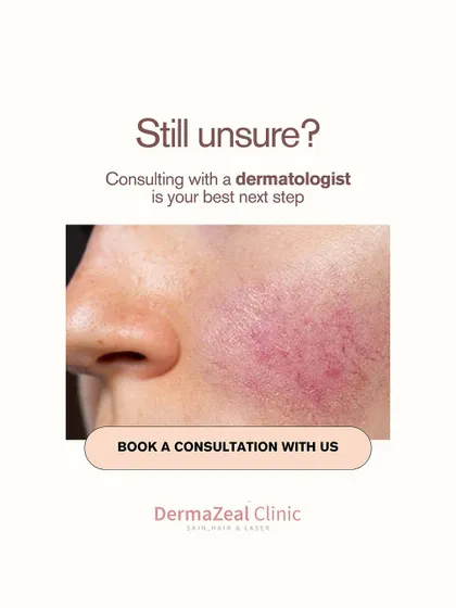 If you are still unsure whether you have Rosacea or how to manage it, your best next step is to consult a dermatologist. I can provide a clear diagnosis and guide you toward the right treatment path.