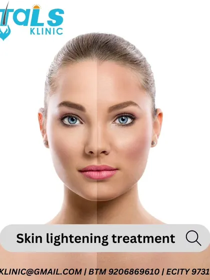 If you are looking for a safe and effective skin lightening treatment, my clinic offers professional solutions. My goal is to improve your skin's clarity and tone for a healthy, radiant complexion.