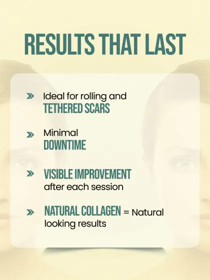 Our Subcision with RF treatment delivers lasting, natural-looking results with minimal downtime. It is particularly effective for rolling and tethered scars, with visible improvement seen after each session as new collagen is formed.