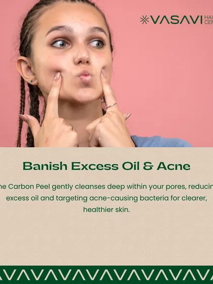 One of the key benefits of the Carbon Peel is its ability to banish excess oil and acne. The treatment gently cleanses deep within your pores, reducing oil and targeting acne-causing bacteria for clearer, healthier skin.