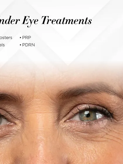 A summary of my under-eye treatments, including Boosters, PRP, Peels, and PDRN, each designed to address specific concerns.