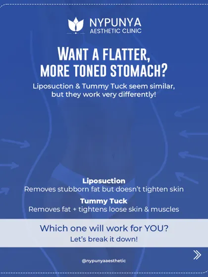 Many patients ask about the difference between a tummy tuck and liposuction. Liposuction is excellent for removing stubborn fat if your skin is firm, while a tummy tuck is designed to remove excess skin and tighten separated abdominal muscles, often after pregnancy or weight loss.
