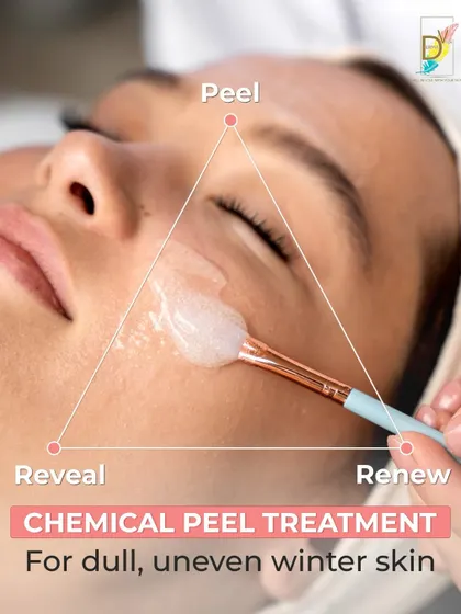 A chemical peel is a three-step process: Peel, Renew, and Reveal. I customize the strength and type of peel based on your skin's needs to safely exfoliate dead skin cells, revealing smoother texture and improved clarity. It's particularly effective for dullness and uneven tone.