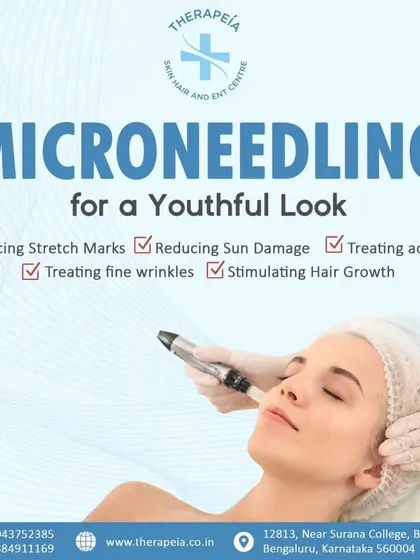 Microneedling is a versatile treatment I use for various concerns. It helps reduce acne scars and stretch marks, treats fine wrinkles, and can even stimulate hair growth by promoting the skin's natural healing and collagen production.