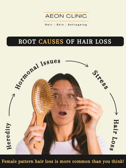 Female pattern hair loss is more common than you think and can be caused by hormones, stress, or heredity. Understanding the cause is the first step to effective treatment.