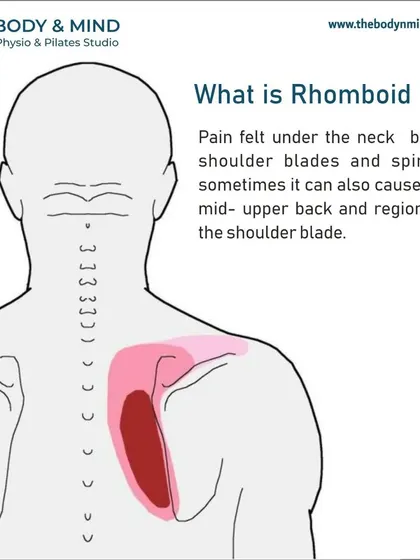 Rhomboid pain is felt under the neck and between the shoulder blades. It's a common complaint that I treat with targeted therapy.