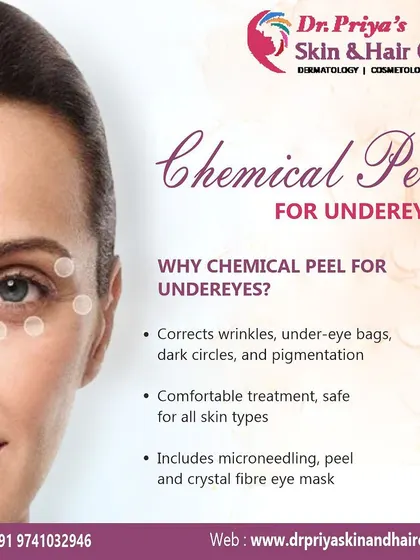 My undereye chemical peel is a comfortable treatment that is safe for all skin types. It corrects wrinkles, bags, and dark circles, and includes microneedling and a crystal fibre eye mask for comprehensive results.