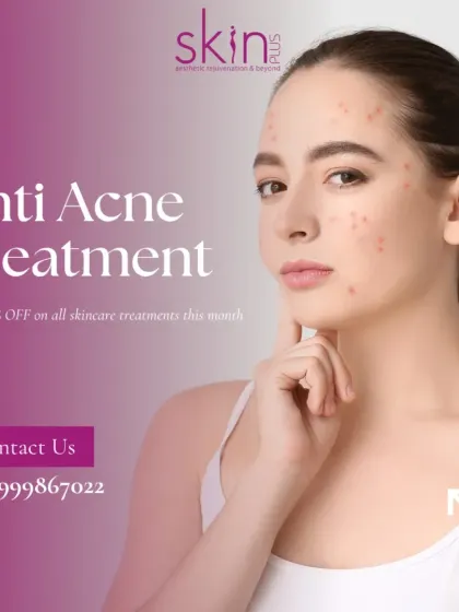 An image promoting my anti-acne treatments, designed to help clients achieve clear, healthy skin.