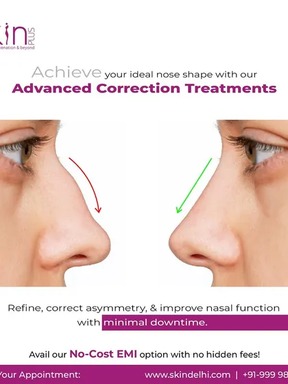 Achieve your ideal nose shape with our advanced correction treatments. We can refine the bridge, lift the tip, and correct asymmetry using non-surgical techniques for natural-looking results with minimal downtime.