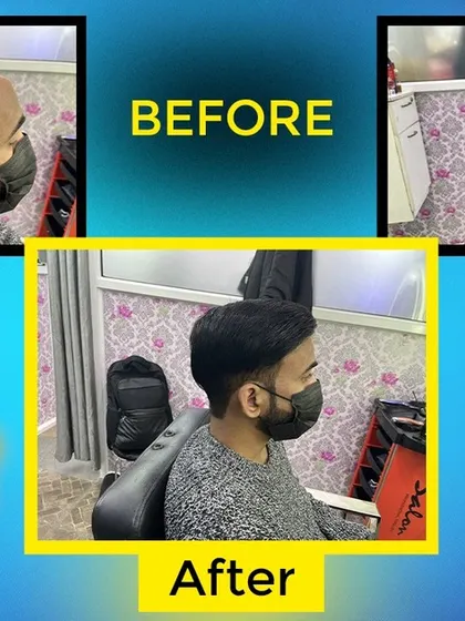 This image shows the detailed process of our hair patch service. The final 'after' shot displays a clean, well-blended hairstyle that looks fantastic.