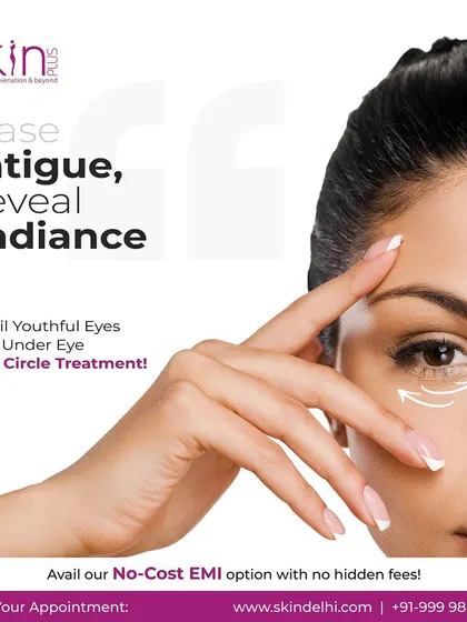 A promotional graphic for my under-eye dark circle treatment, promising to erase fatigue and reveal radiance for more youthful-looking eyes.