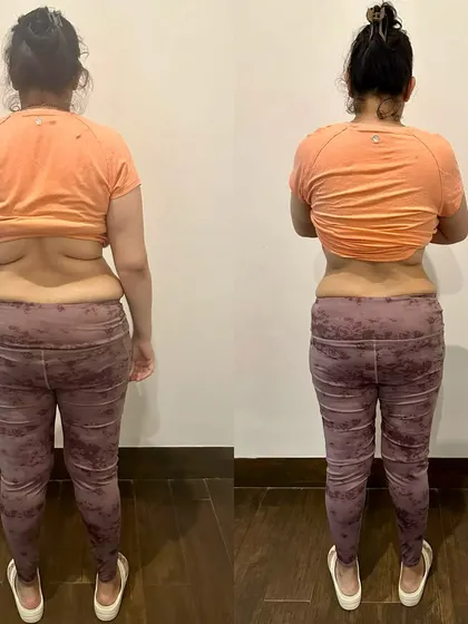 The back view of this postpartum client's progress. Notice the significant reduction in back fat and a more defined waistline, results of her hard work and consistency.