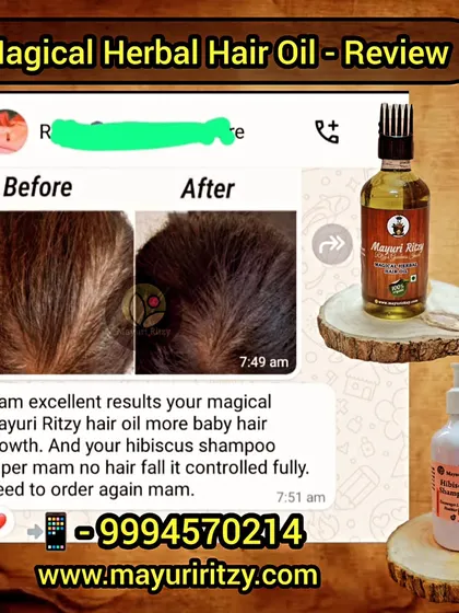 Look at the amazing baby hair growth and controlled hair fall this customer experienced. This is the result of combining my Magical Herbal Hair Oil with the gentle, effective cleansing of my Hibiscus Shampoo.
