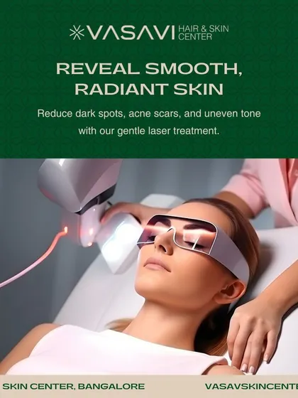 This image shows a gentle laser treatment designed to reveal smooth, radiant skin. By targeting dark spots, acne scars, and uneven tone, this procedure helps restore the skin's natural luminosity with minimal downtime.