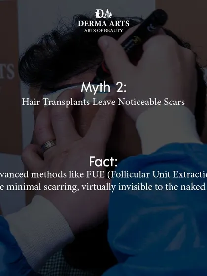 Myth: Hair transplants leave noticeable scars. Fact: Advanced methods like FUE, which I specialize in, involve extracting individual follicles, leaving behind minimal scarring that is virtually invisible to the naked eye.
