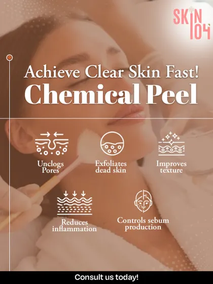 Achieve clear skin fast with a chemical peel. This infographic explains how the treatment works to unclog pores, exfoliate dead skin, improve texture, reduce inflammation, and control sebum production for a balanced complexion.