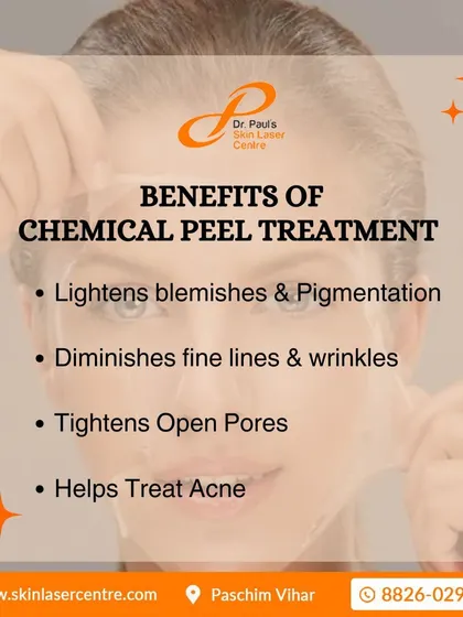 Here are the key benefits of a chemical peel treatment. It is a versatile procedure that lightens blemishes, diminishes fine lines, tightens open pores, and helps treat acne.