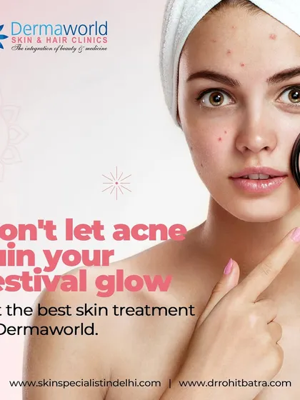 Don't let acne ruin your festive glow. Breakouts often appear at the most inconvenient times, but with the right treatment from my clinic, you can face any event with clear, confident skin.
