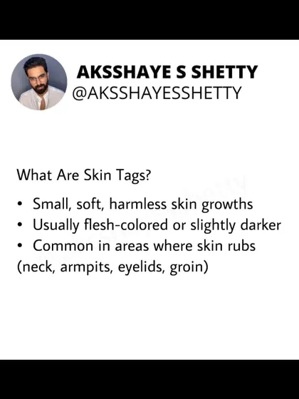 What are skin tags? They are small, soft, harmless skin growths that are common in areas where skin rubs, like the neck, armpits, and groin. They are often a sign of underlying insulin resistance.