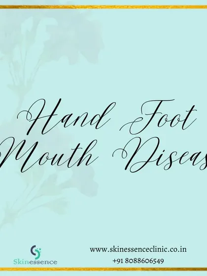 Hand, Foot, and Mouth Disease (HFMD) is a common viral illness, especially in young children. This series of posts provides essential information for parents on how to recognize, manage, and prevent the spread of this contagious disease.