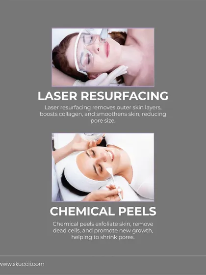 Two classic and effective treatments for shrinking pores are Laser Resurfacing and Chemical Peels. Laser boosts collagen and smoothens skin, while peels exfoliate dead cells and promote new, healthier skin growth for a refined texture.