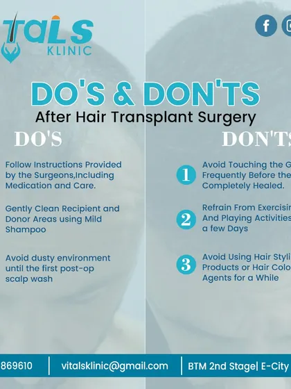 Proper aftercare is crucial for the success of your hair transplant. This guide outlines the essential do's and don'ts, such as following medication instructions, gentle cleaning, and avoiding strenuous activities to protect the newly implanted grafts.