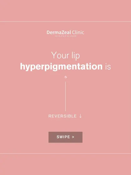 Good news: your lip hyperpigmentation is reversible. With the right treatment plan, we can work to restore the natural color and health of your lips.