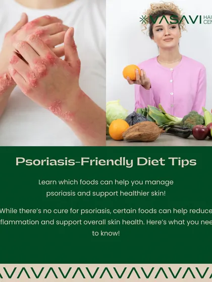 While there is no cure for psoriasis, certain lifestyle choices can help manage the condition. This series of images provides dermatologist-recommended tips on what to eat and what to avoid to help reduce inflammation and support your skin.