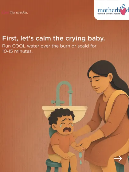 The first and most important step for a minor burn or scald is to run cool, not cold, water over the area for 10-15 minutes. This helps to soothe the skin and reduce the temperature, preventing further damage.