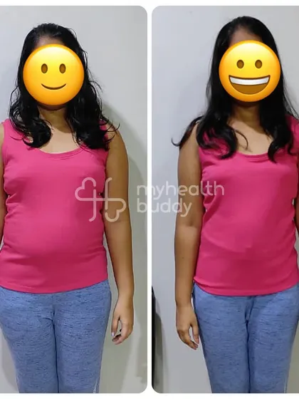 Front view of the 6kg loss, showing a much healthier and fresher look.