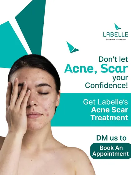 Don't let acne or scars affect your confidence. Our specialized acne scar treatments are designed to effectively reduce their appearance, helping you regain smooth and clear skin.